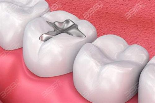 成人全麻补牙过程视频,轻松舒适,告别恐惧