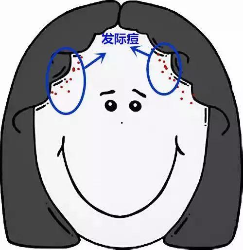 成人脸上长痘视频大全